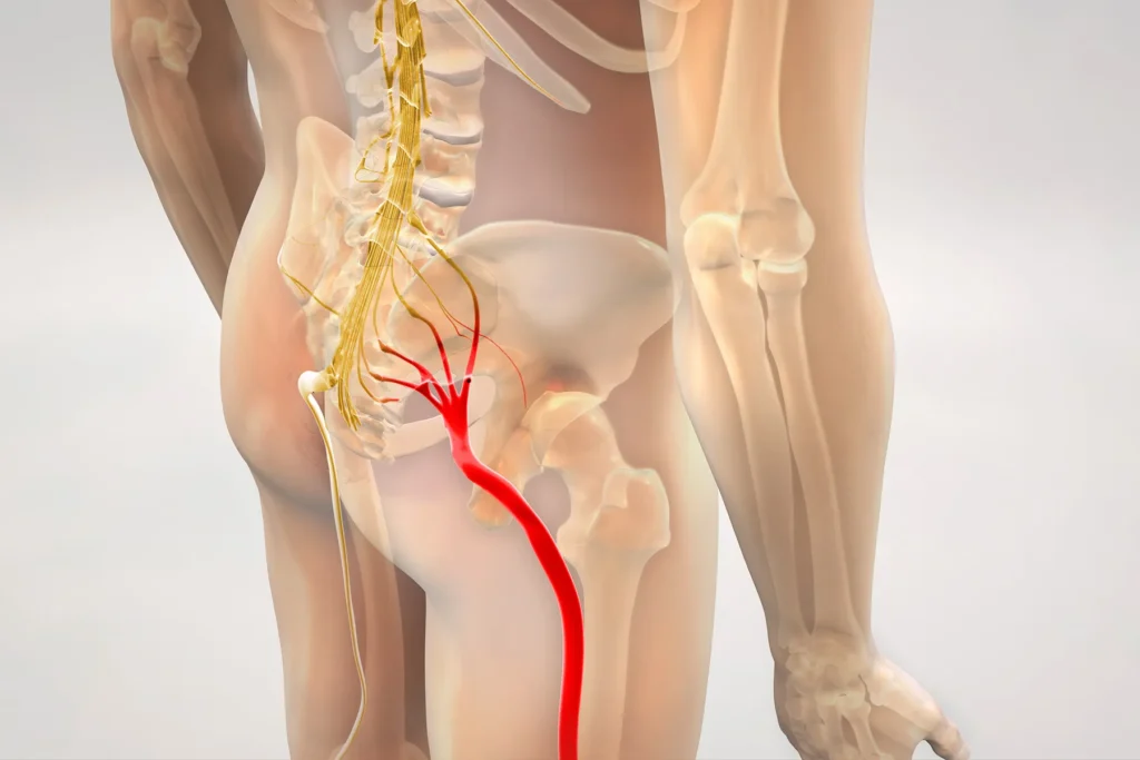 Best Sciatica Pain Treatment In Ahmedabad