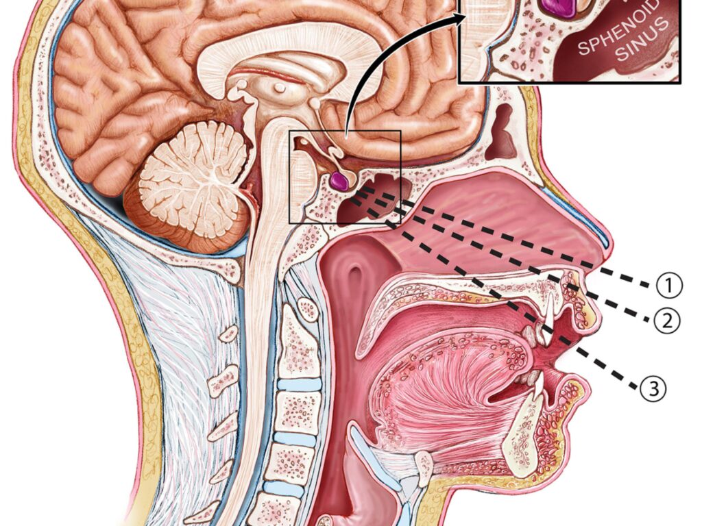 Skull Base Treatment in Ahmedabad