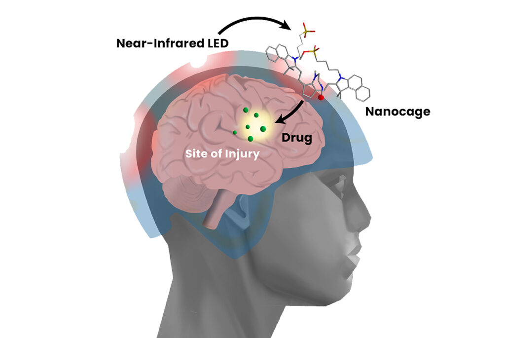 brain injury treatment in Ahmedabad