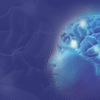 Brain Aneurysm Surgery in Ahmedabad