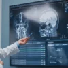 How to Speed Up Recovery after Neurosurgery in Ahmedabad?